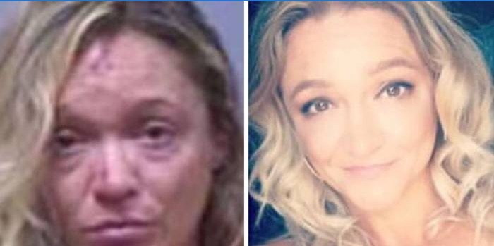 Femeie înainte și după abuzul de alcool