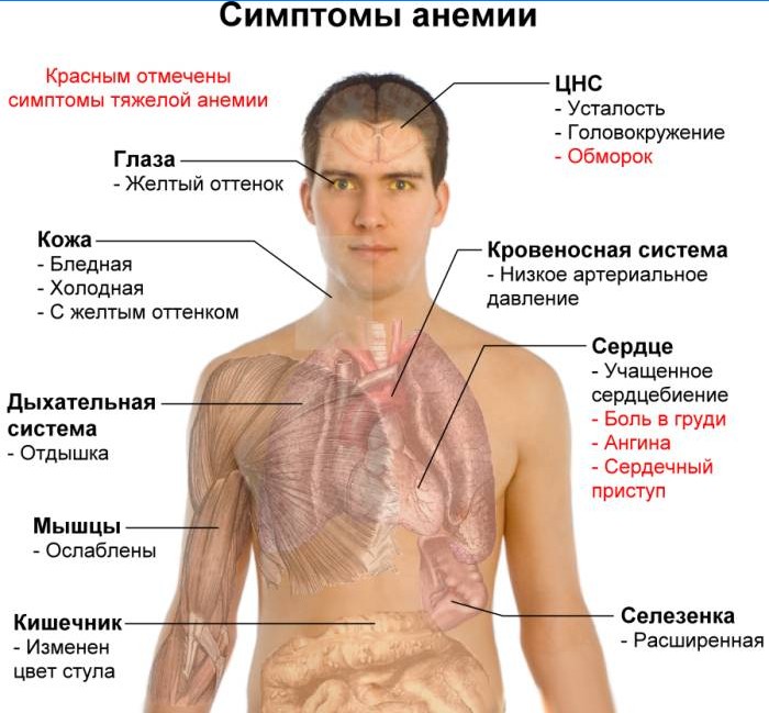 Simptomele anemiei