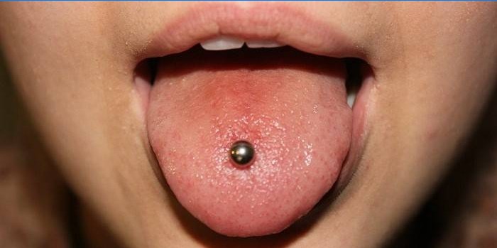 Totul despre piercing-ul limbii: piercing, plecare, posibile consecințe - Sinuzită