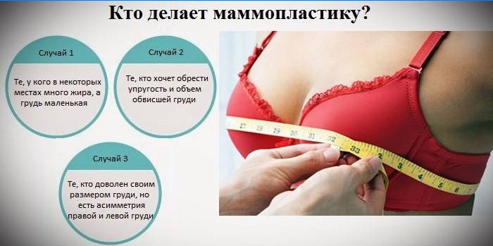 Indicații pentru mamoplastie