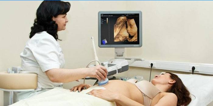 Scanare cu ultrasunet