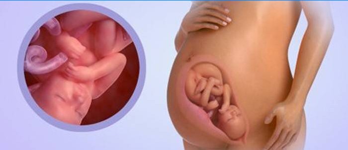 Bebeluș la 38 de săptămâni însărcinată